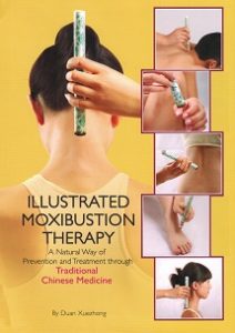 Illustrated Moxibustion Therapy