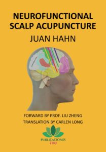 Neurofunctional scalp acupuncture